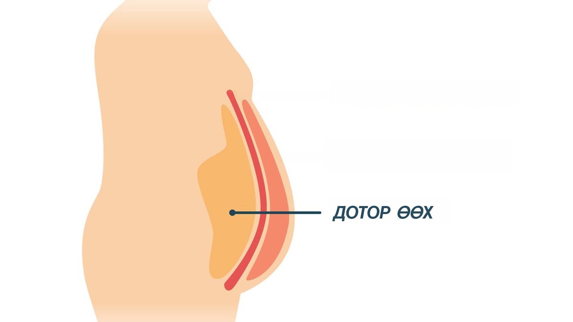 Дотор өөх: Үл үзэгдэх аюул (фото 1)