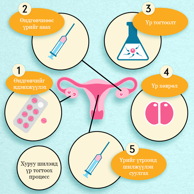 Ээж болохын хүслэн: Хуруу шилний хүүхдүүд хэрхэн төрдөг вэ? (фото 5)